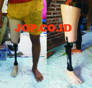 kaki palsu atas lutut dengan konektor sendi
