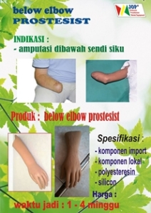 below elbow prostesis